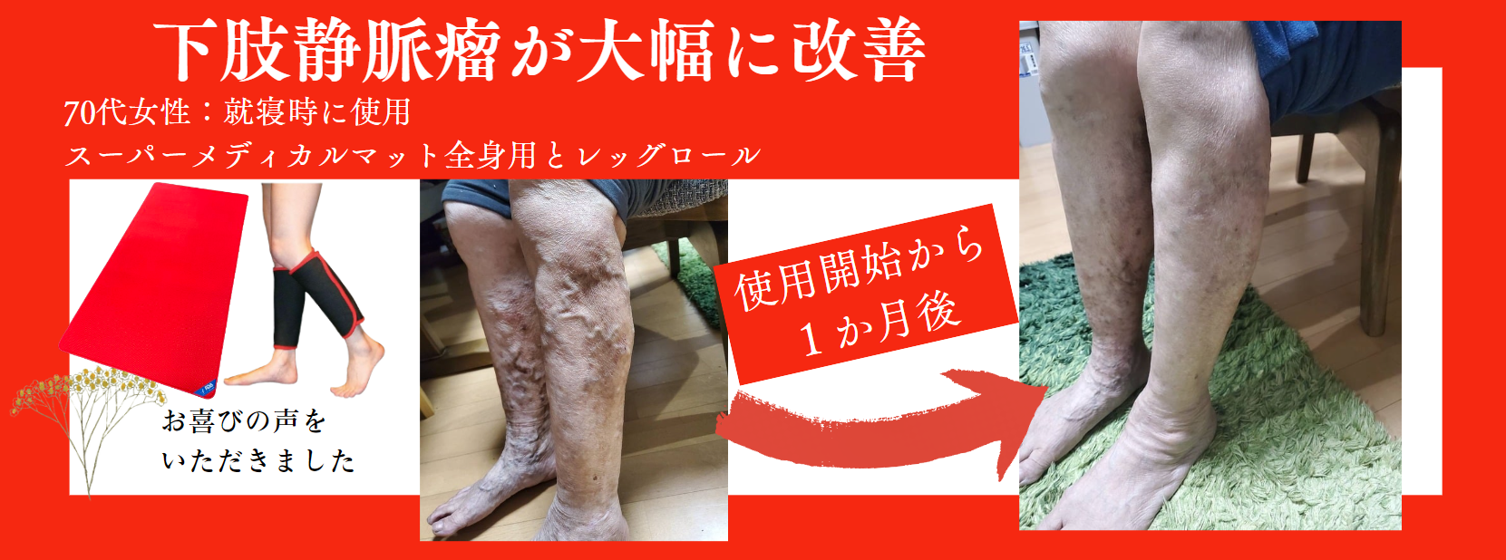 スーパーメディカルマット全身用 | マット | 公式メホール